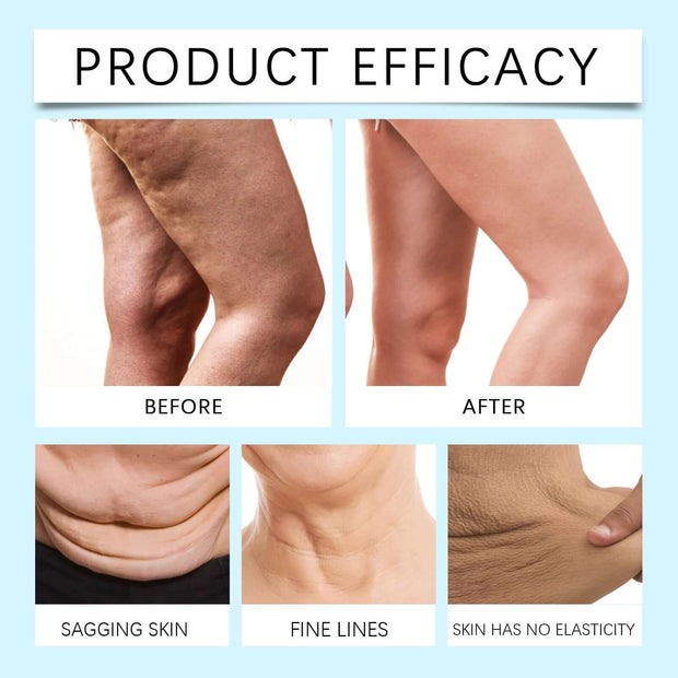 Body Butter Anti-wrinkle Tightening Cream - ENova